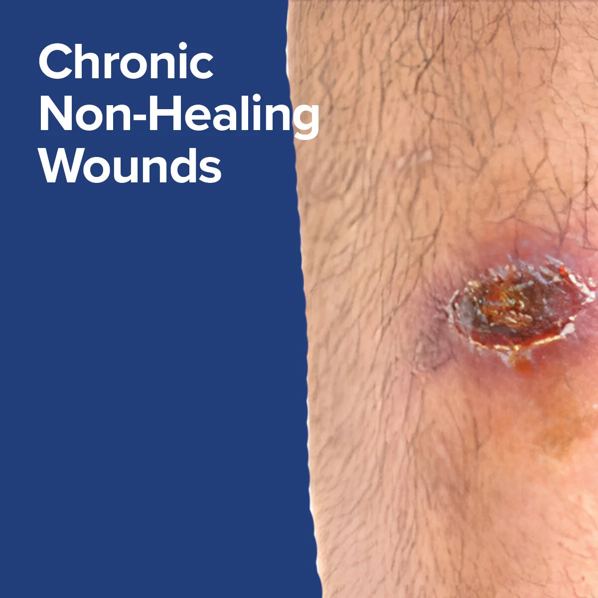 CHRISTUS Wound Care Medical Center San Marcos | WoundCentrics, LLC